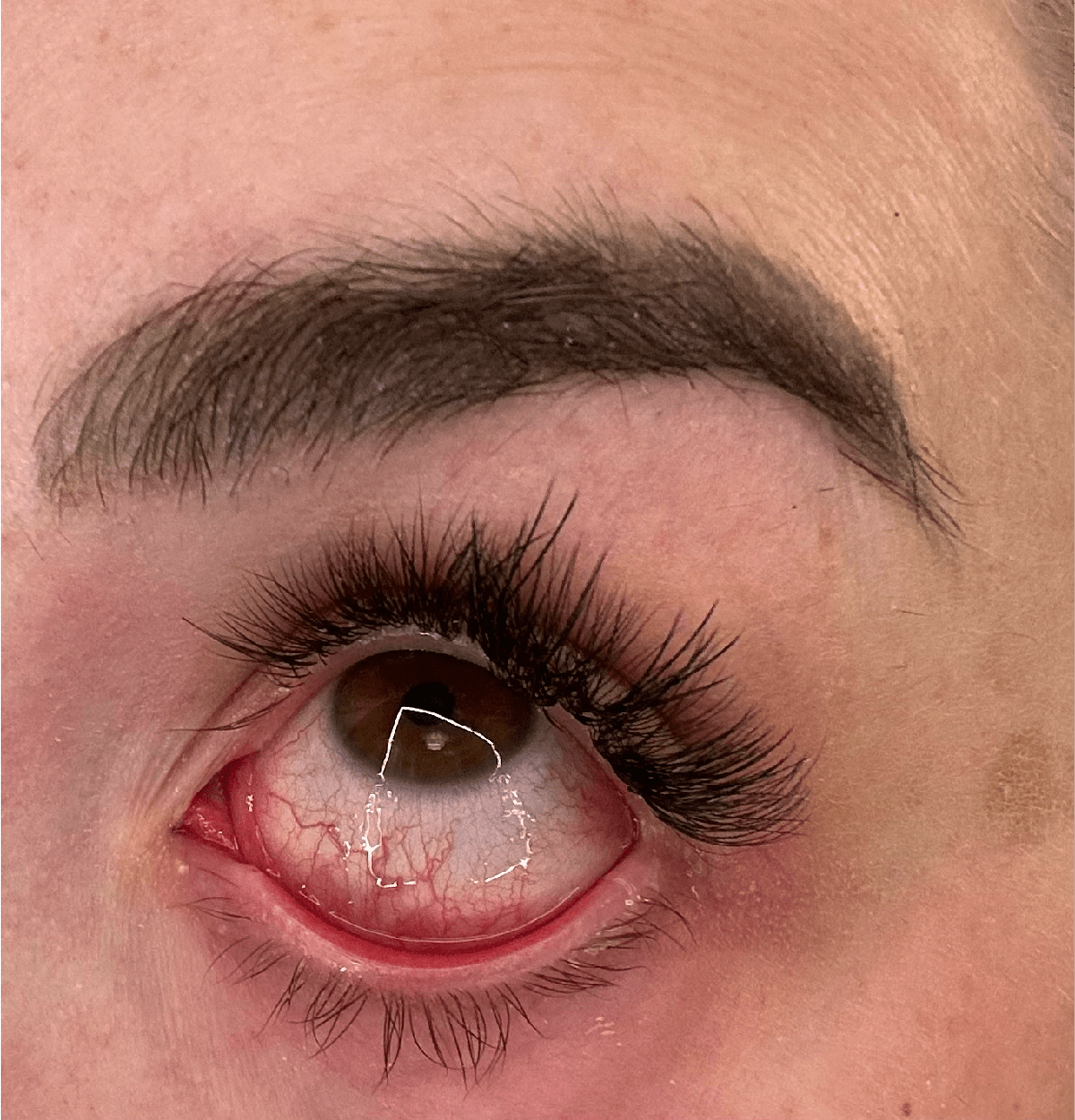 Update May 2023: Got sick. Finally healing. Beware of mold.
